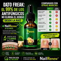 NailRenew™– Adiós hongos en uñas, resultados en solo 1 semana